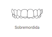 sobremordida