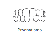 prognatismo