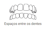 espaços entre os dentes