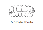 mordida aberta