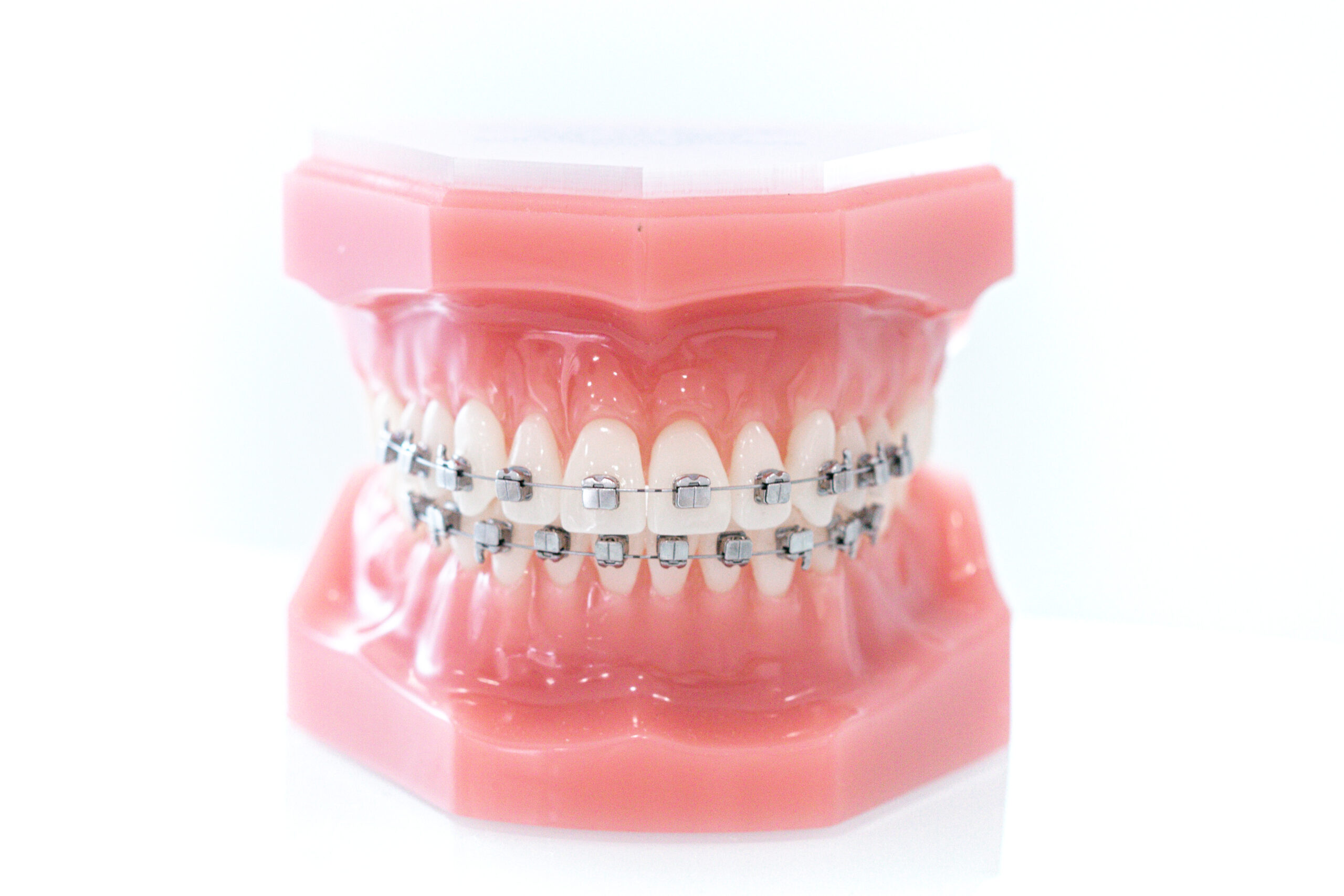 aparelho fixo metálico