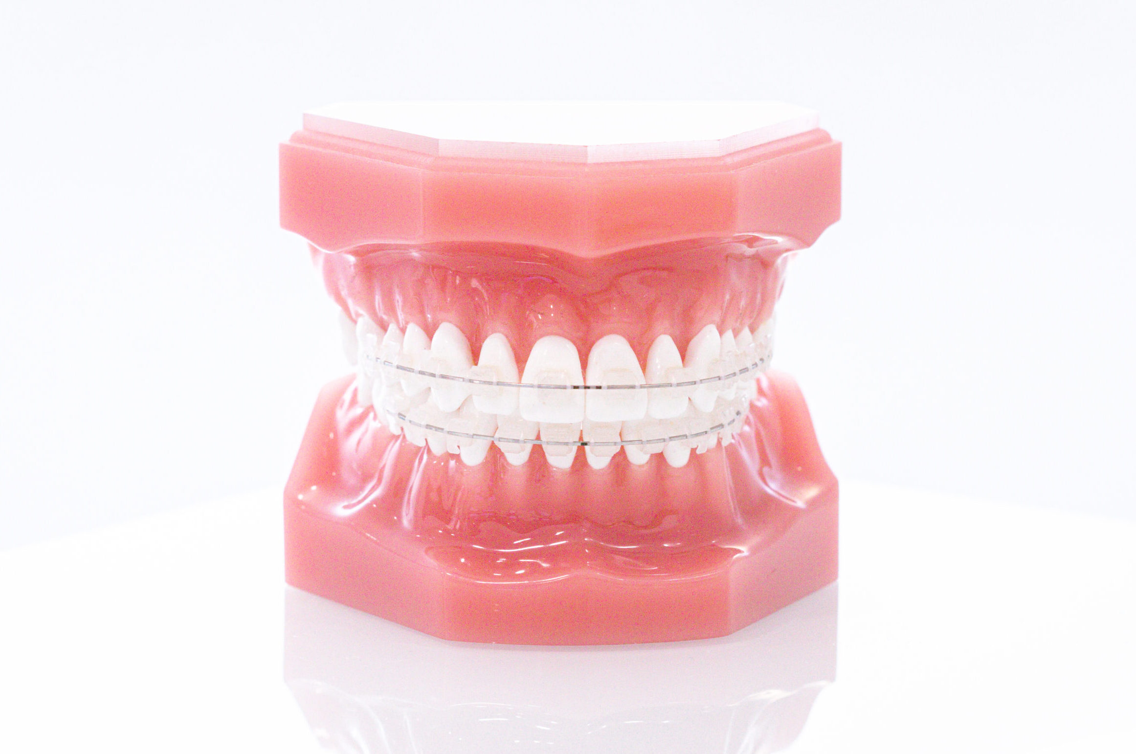 aparelho fixo estético